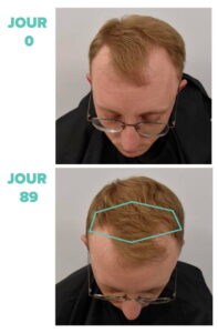 ulti-paris-research-results